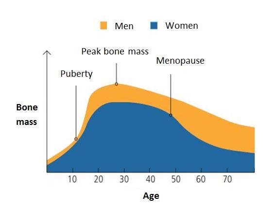 Beware of this silent bone disease